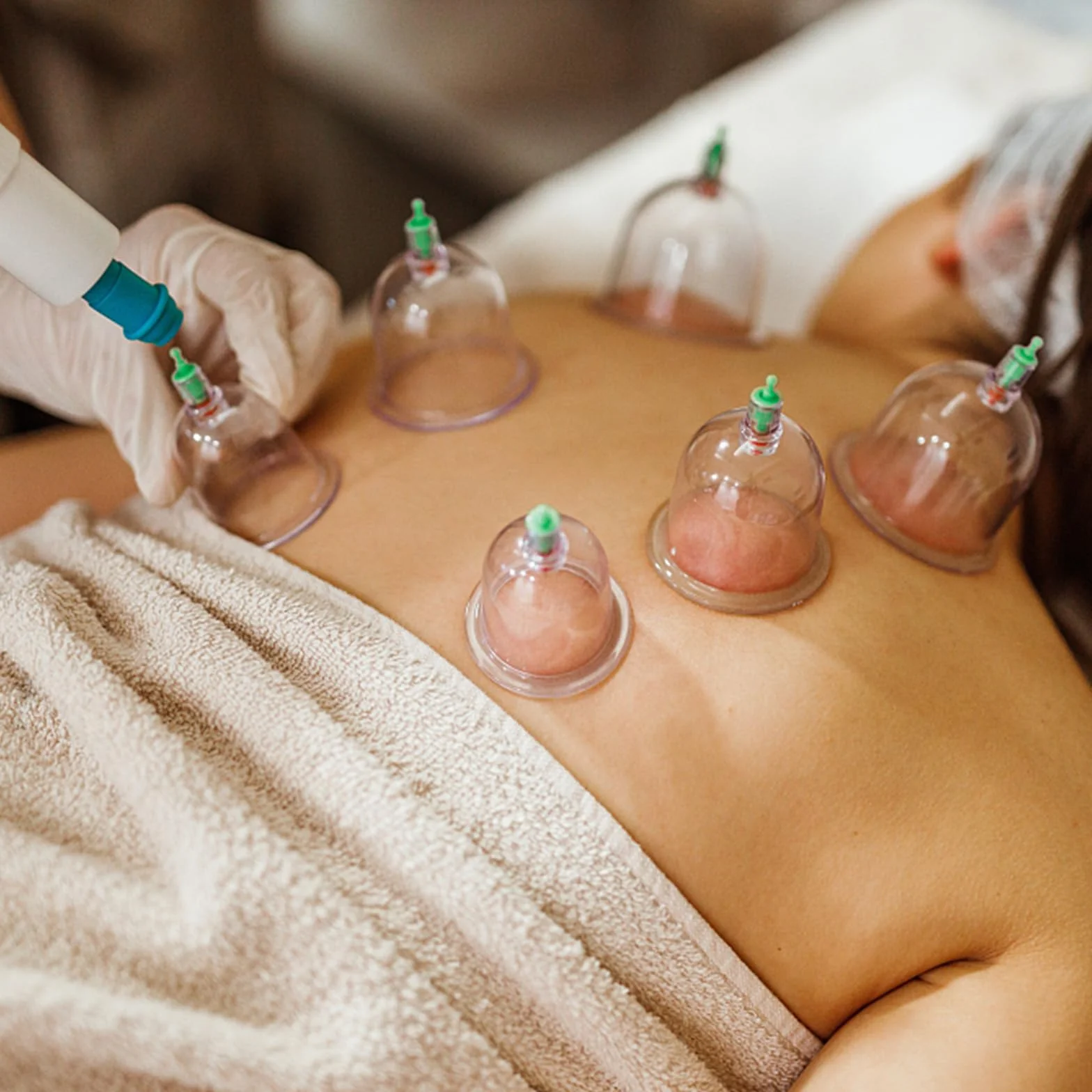 Zestaw bańek Cupping Therapy: 12 sztuk bańek z pompą próżniową, bańki z uchwytem pompki i rurką przedłużającą, zestaw bańek do terapii całego ciała