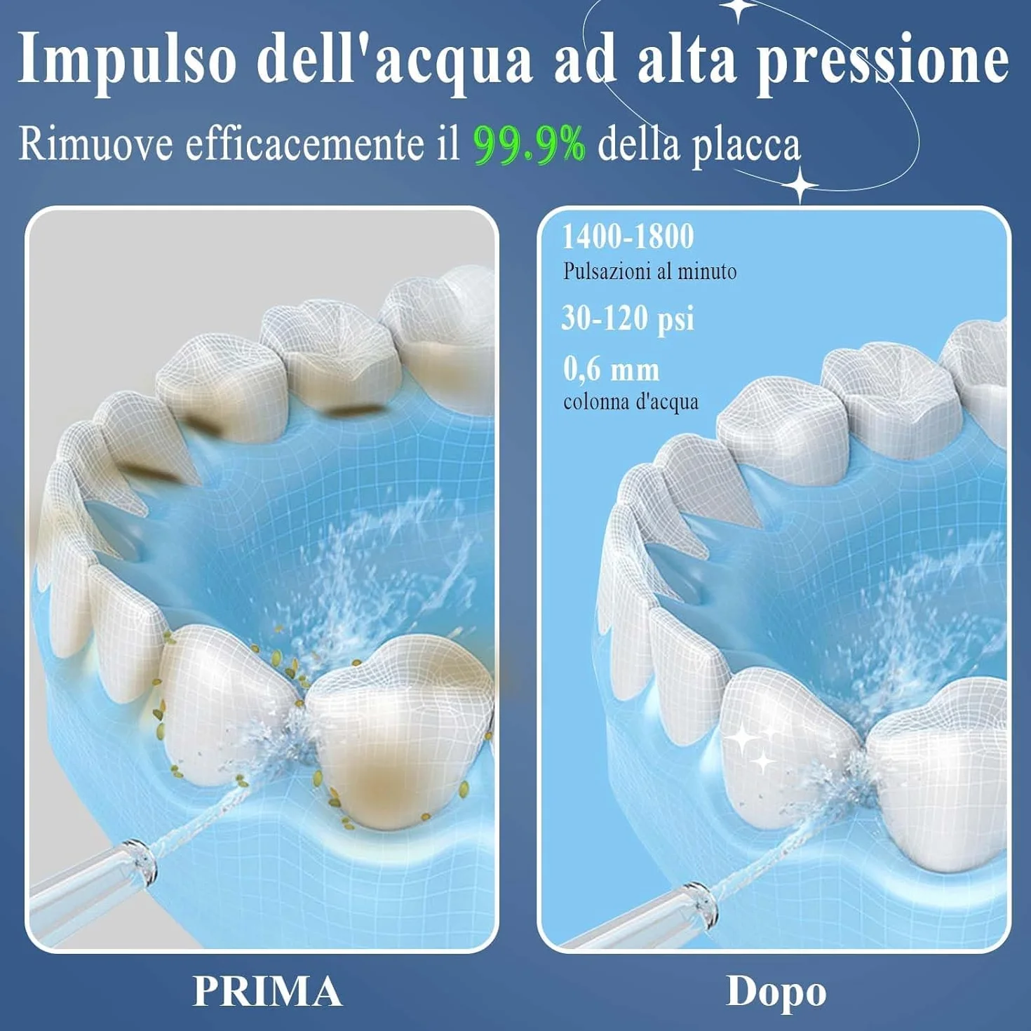 SURFOU Hydropulsor Dental Przenośny Elektryczny Flosser Zraszacz jamy ustnej