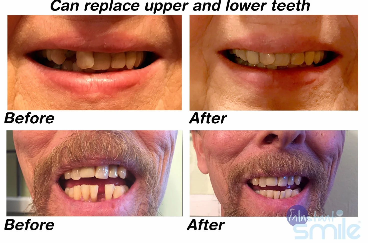 Instant Smile Multishade Zestaw do Naprawy Zębów