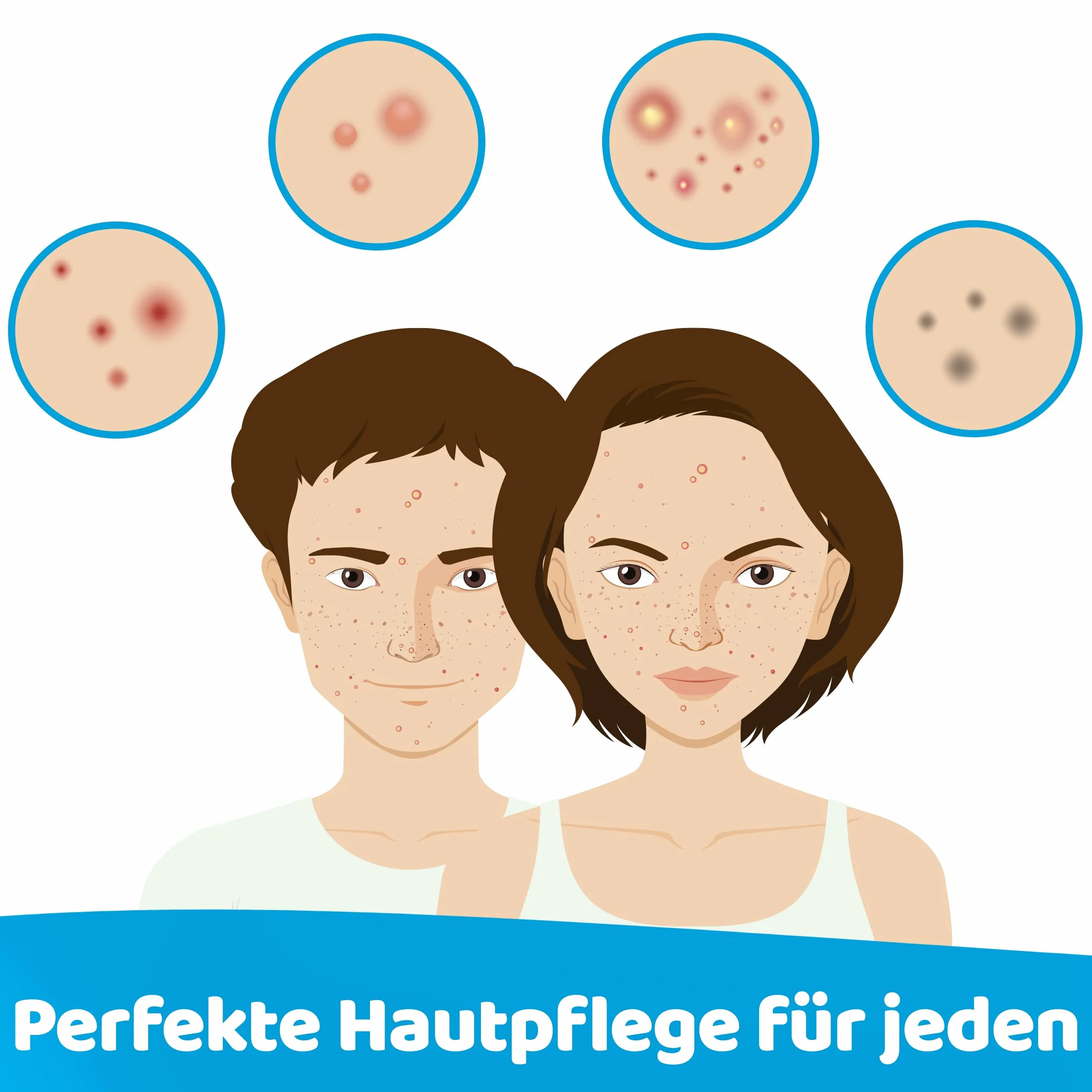 Prontomed HypoClear Spray przeciw trądzikowi 75ml – Skuteczna pielęgnacja skóry z kwasem podchlorawym/Hypochlorus Acid | na trądzik, niedoskonałości skóry i zaczerwienienia | Dla czystej, zdrowej
