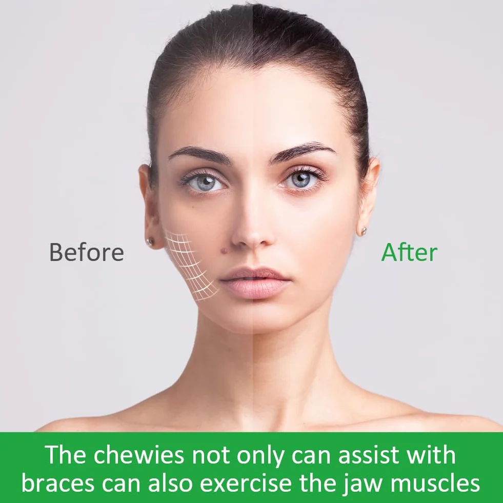 OFFCUP Aligner Chewies, 20 sztuk seater aligner, tablety Chewies, przegródki wyrównujące, seater chewies w 1 kolorach (białe)