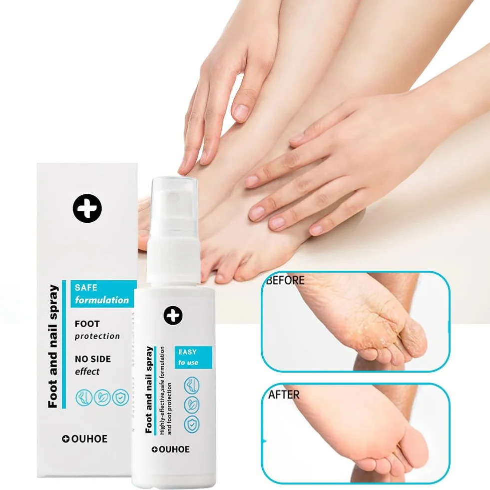 Spray do stóp i paznokci, 2 sztuki, do pielęgnacji stóp, usuwanie nieprzyjemnych zapachów, dla mężczyzn i kobiet, 30 ml