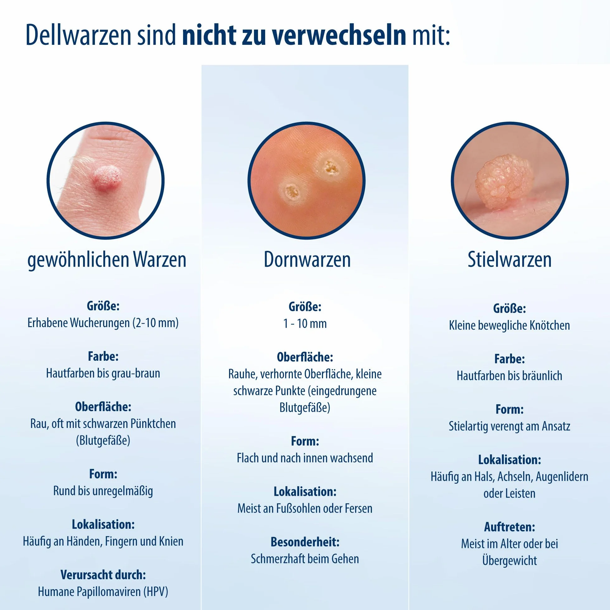 Evolsin Środek na brodawki zakaźne dla dzieci i dorosłych od 2 lat