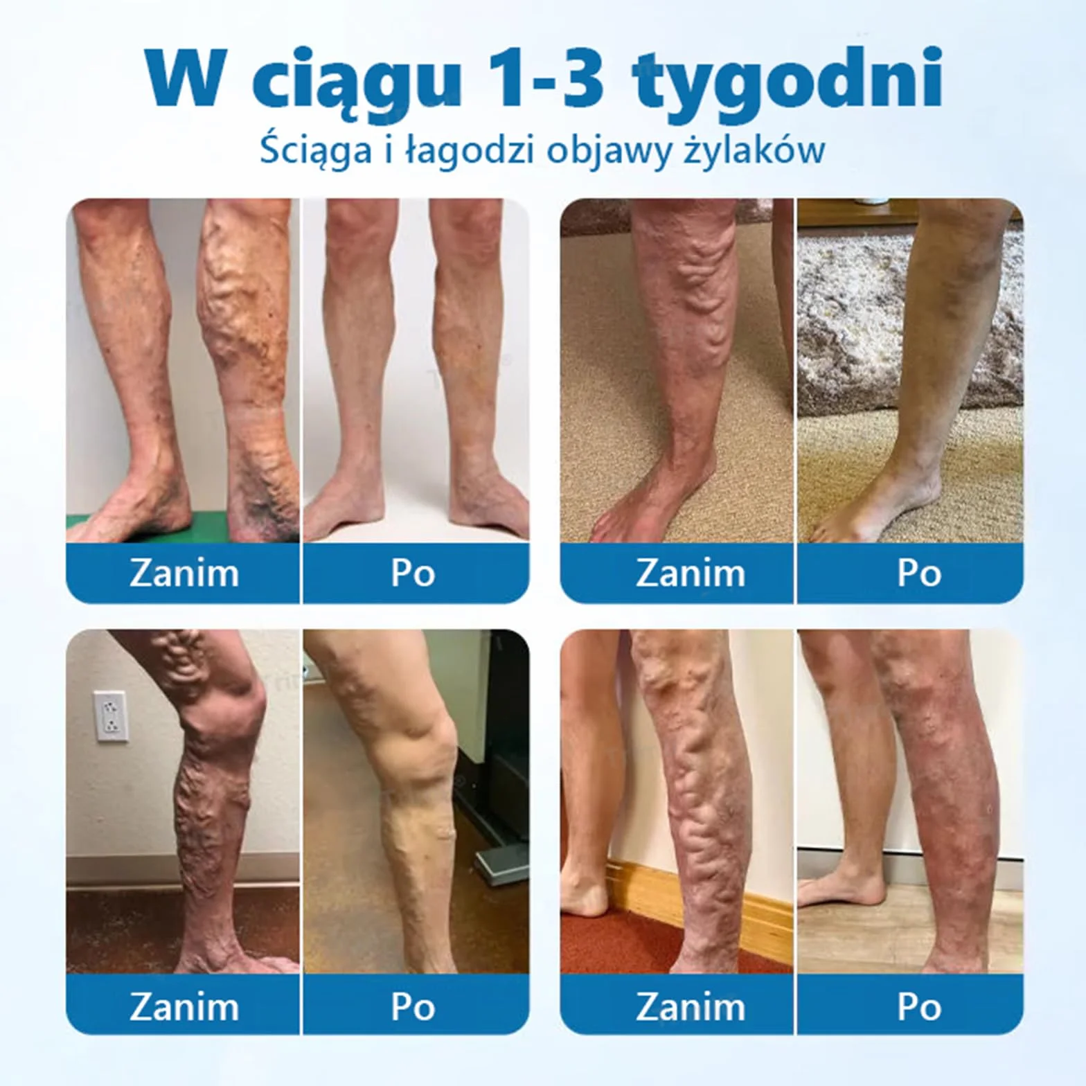Trimil ziołowy Spray, profesjonalny spray do leczenia, Trimil Spray na Żylaki, Naturalne Spray na łydki przeciw żylakom (1)