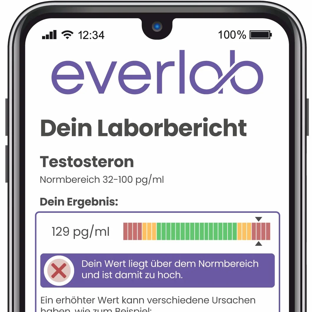 Test testosteronu – wolne stężenie testosteronu szybko i łatwo sprawdzić | test na ślinę | samodzielny test do domu