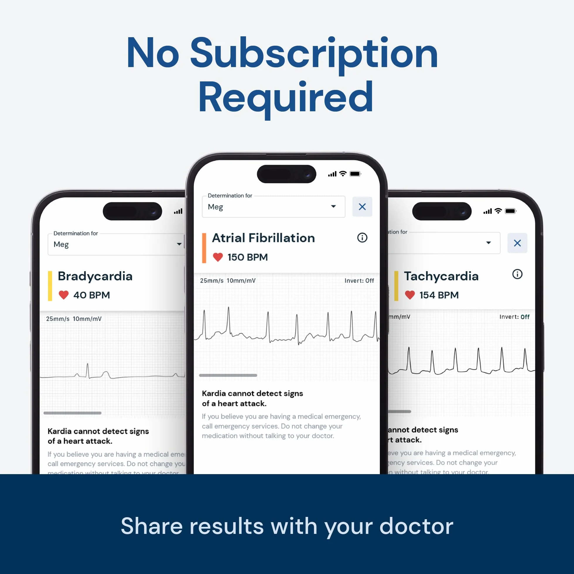KardiaMobile osobisty jednoprzewodowy monitor EKG wykrywa migotanie przedsionków arytmie wyniki 30 sekund