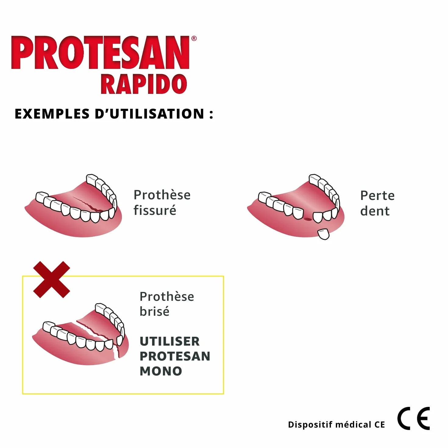 Protesan Rapido 7 Naprawa Protez, Biały, 3 ml