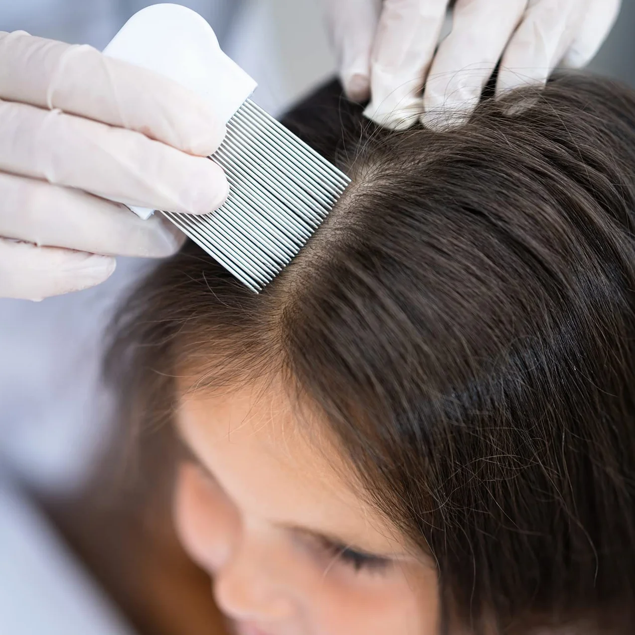 HAIRMED - X2 Organiczny Szampon przeciw wszom i gnidom - Idealny roztwór dla dzieci - bez siarczanów, parabenów i silikonu - 200 ml