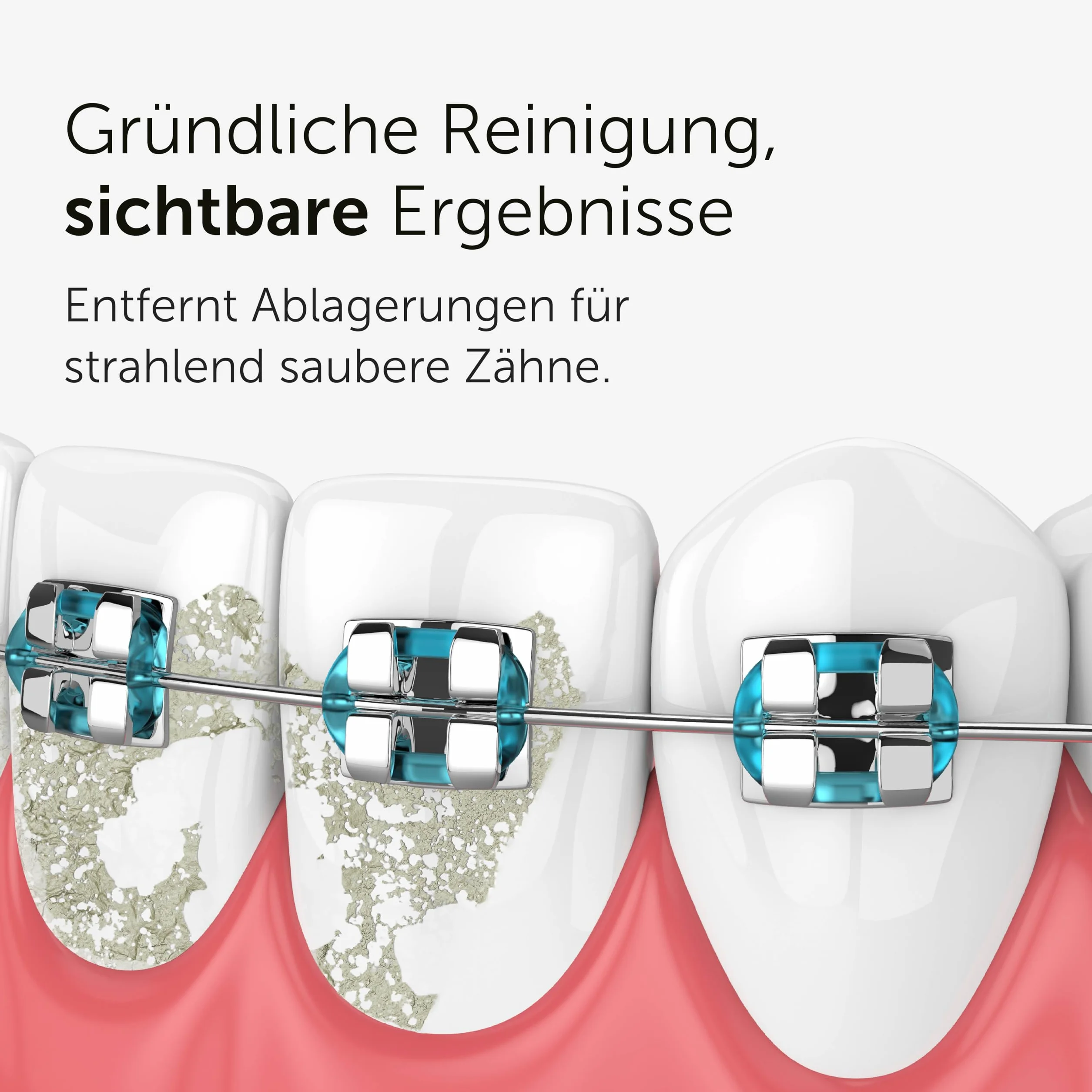Wondersmile Dysza do płytki nazębnej – wymienne dysze do irygatora jamy ustnej Waterflow – technologia SmoothFlow zapewnia optymalną pielęgnację zębów i dziąseł (czarna, 4 sztuki)