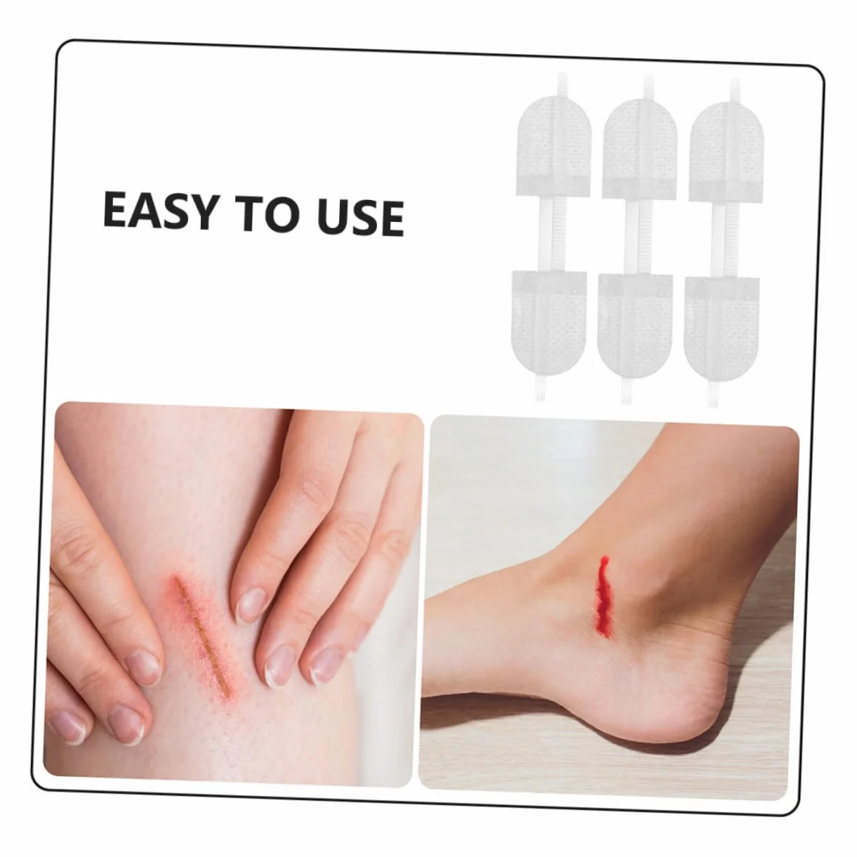 Yardenfun 6 Sztuk Zip Wound Close Bandages Butterfly Closure Strips Quick Stitch Wound Care for Finger And Knuckle Portable Outdoor Emergency Use