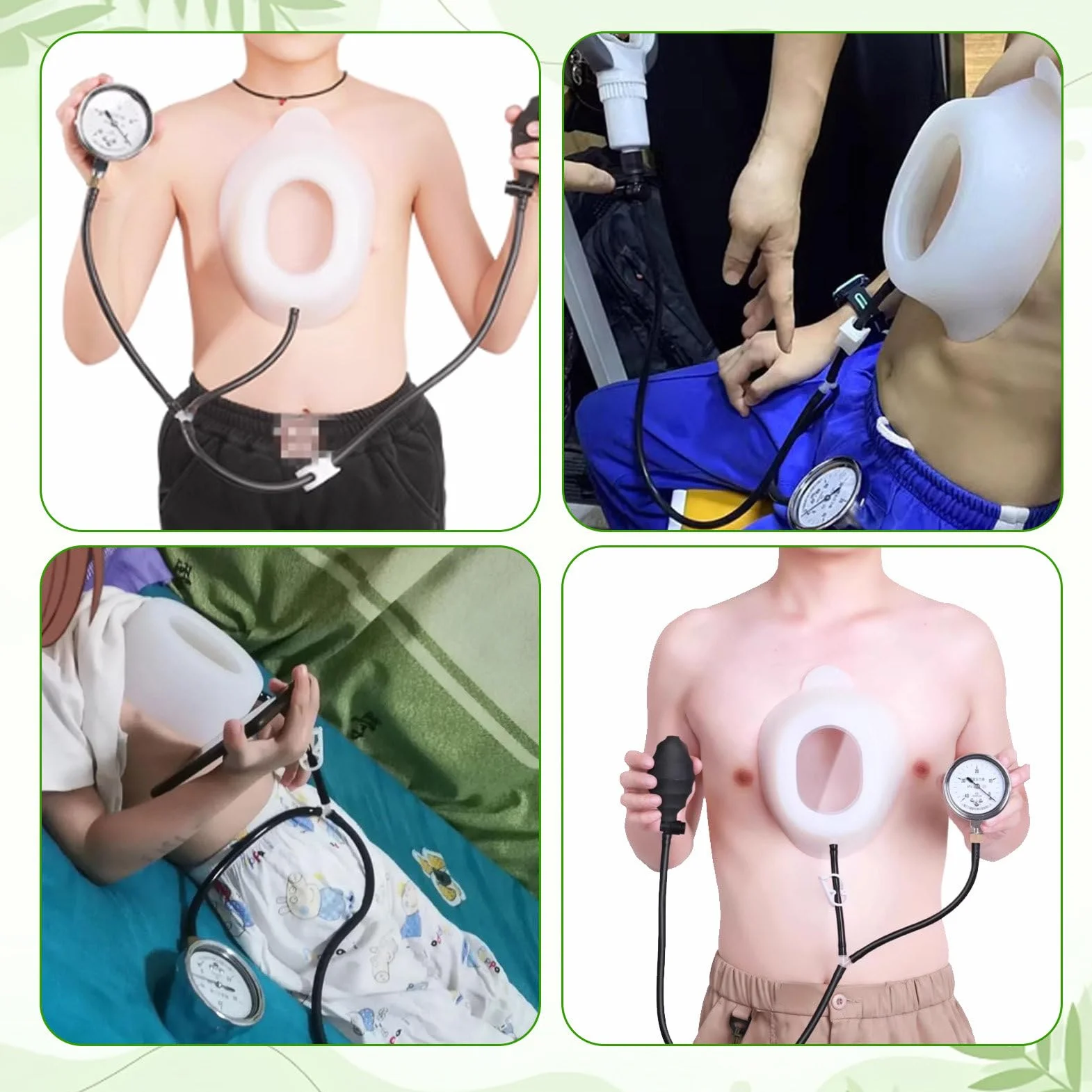 Pectus Excavatum Vacuum Bell, Orteza Na Klatkę Piersiową, Urządzenie Korekcyjne Z Manometrem, Terapia Dzwonem Próżniowym Standard-S