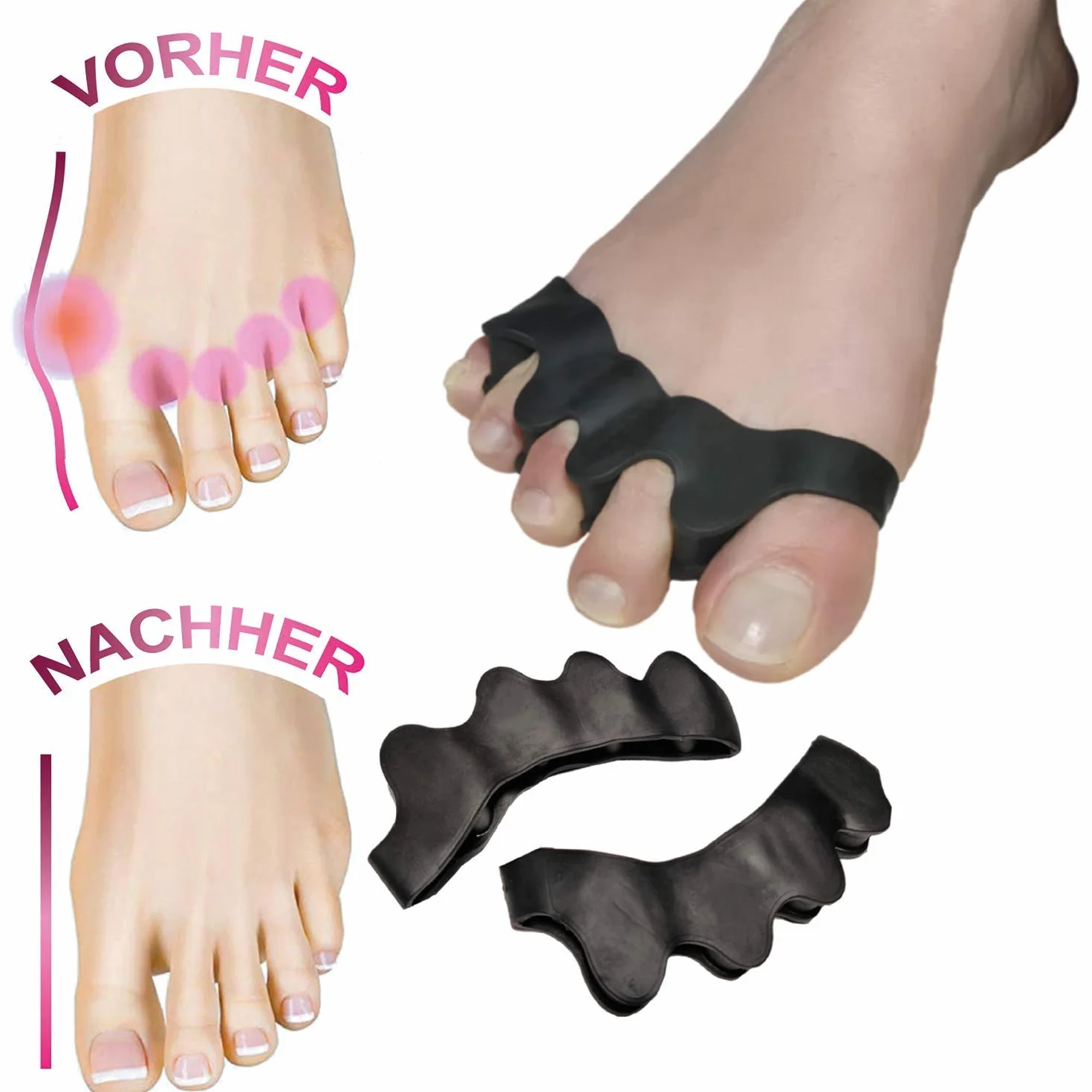 6 x separator palców hallux Valgus szyna na palce palce dla kobiet i mężczyzn - ochrona balowa bandaż również do butów - korekta młotka wyściółka na piłkę nożną I na nogę