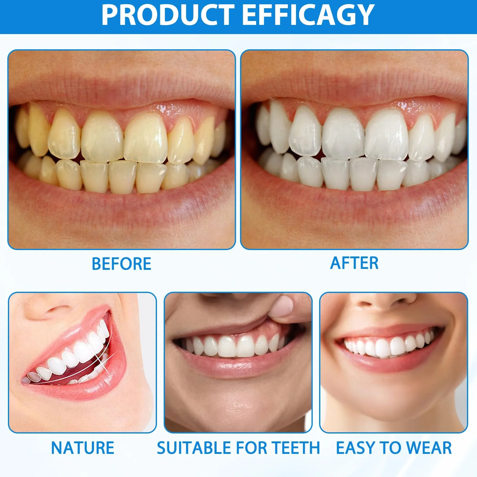 2 sztuki protez zębowych do nakładania Naturalne i przyjemne w noszeniu Veneers Silicone Reline Zestaw protez dla mężczyzn i kobiet Nadaje się do uzyskania pewnego siebie uśmiechu
