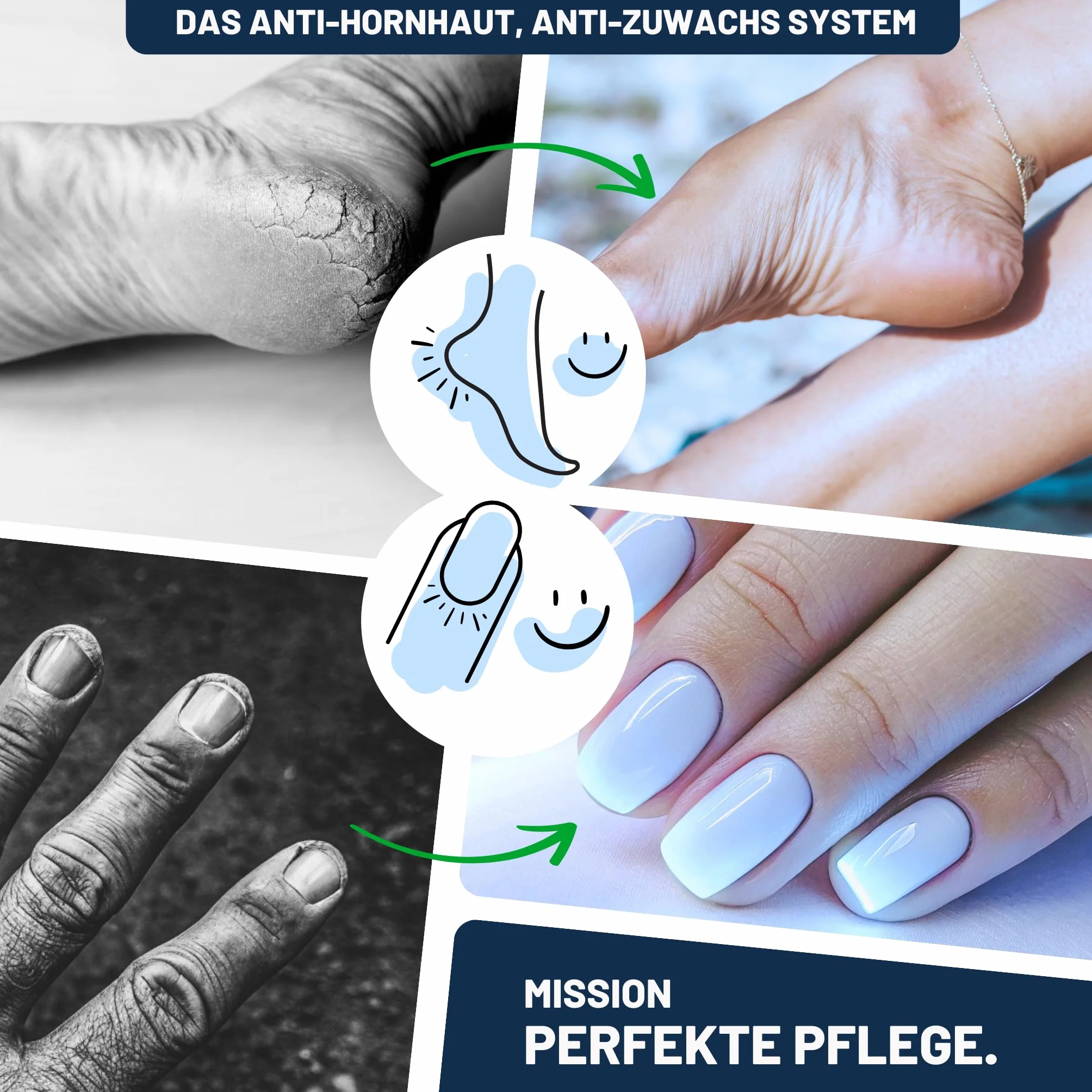 Mr. Fuss Środek do usuwania zrogowaciałego naskórka 250ml Zestaw do pedicure Nr 4
