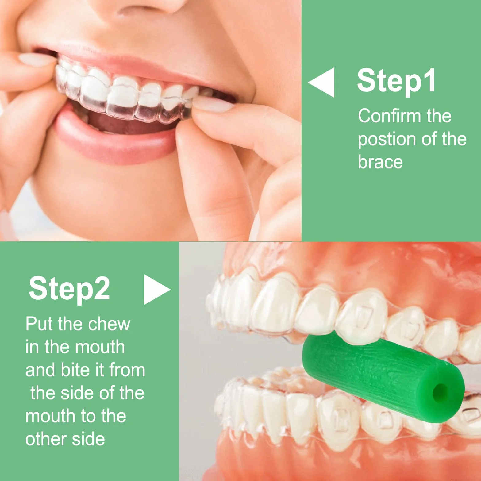 BVN Aligner Chewies 20 sztuk do Aligner Chompers zielona