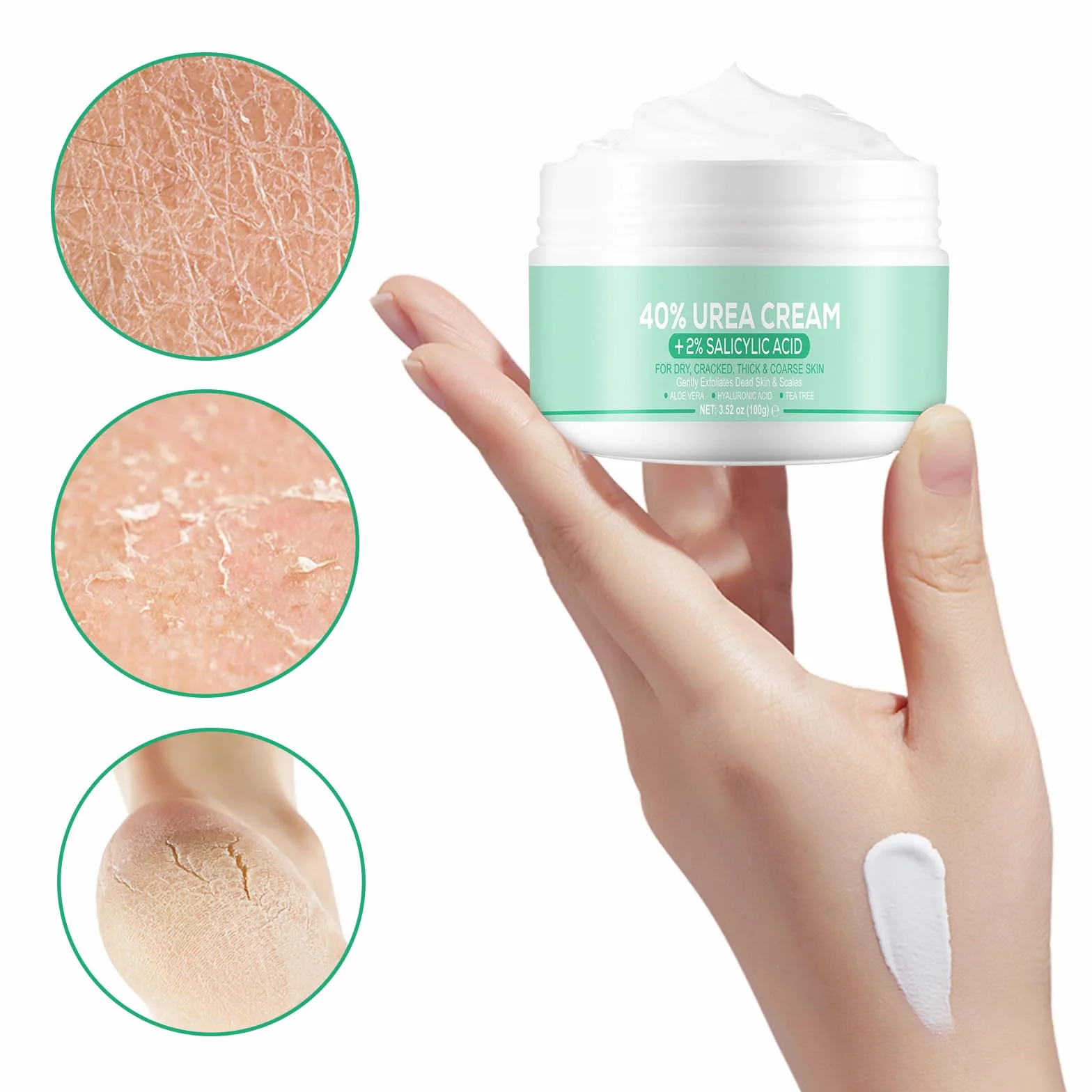 40% Urea Cream, Urea Foot & Hand Cream 3,52 oz do popękanych pięt i suchej skóry, z aloesem, olejkiem z drzewa herbacianego i jojoba do głębokiego nawilżenia, usuwania zrogowaciałego naskórka i