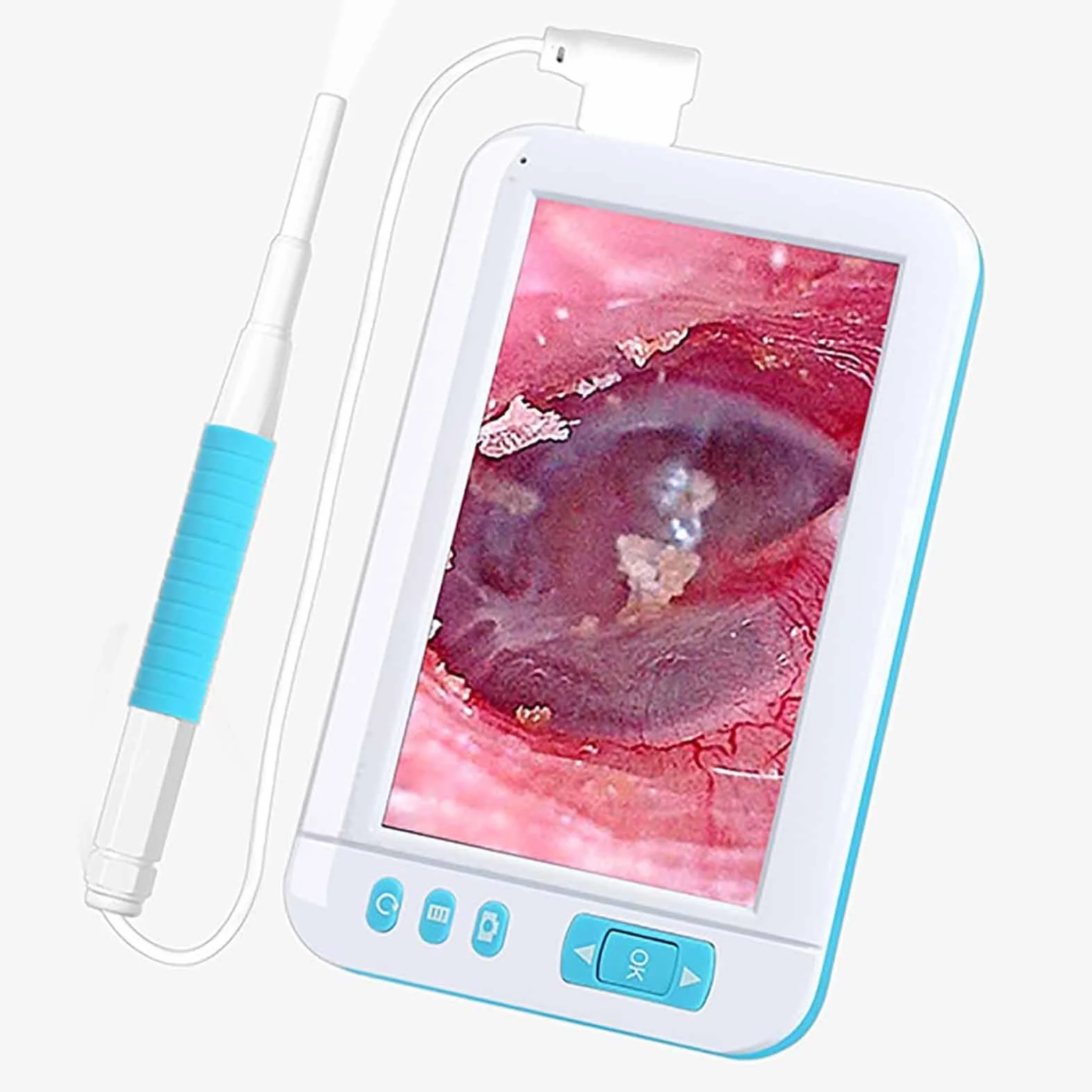 Przenośny cyfrowy Otoskop, Czyściciel uszu z obiektywem HD 1080P 3,9 Mm z 4,3 cala i 6 diodami LED IPS, przenośny zasięg ucha dla dorosłych, dzieci i zwierząt domowych