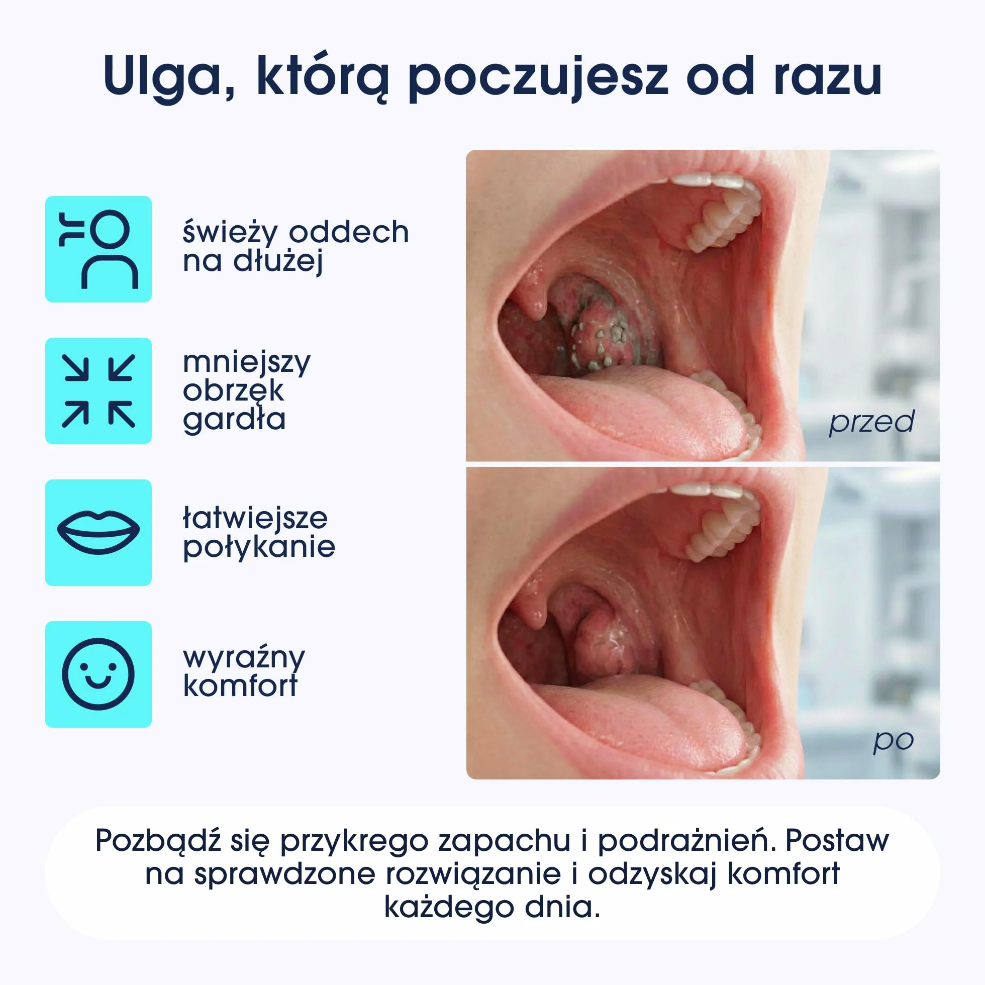 ZENT TonsilCare Urządzenie do usuwania czopków kamieni migdałkowych, Czyszczenie śluzu z gardła, Bezprzewodowe, 3 Poziomy mocy, 3 Silikonowe końcówki, Podświetlenie LED, Ciche działanie