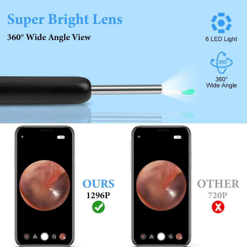 ACWOO Otoskop endoskop, Otoskop cyfrowy, endoskop do uszu, aparat uszy 1296P WIFI oczyszczacz uszu z 6 diodami LED, 4,5 mm HD endoskop ucha, zestaw do czyszczenia uszu dla iOS i Androida (czarny)