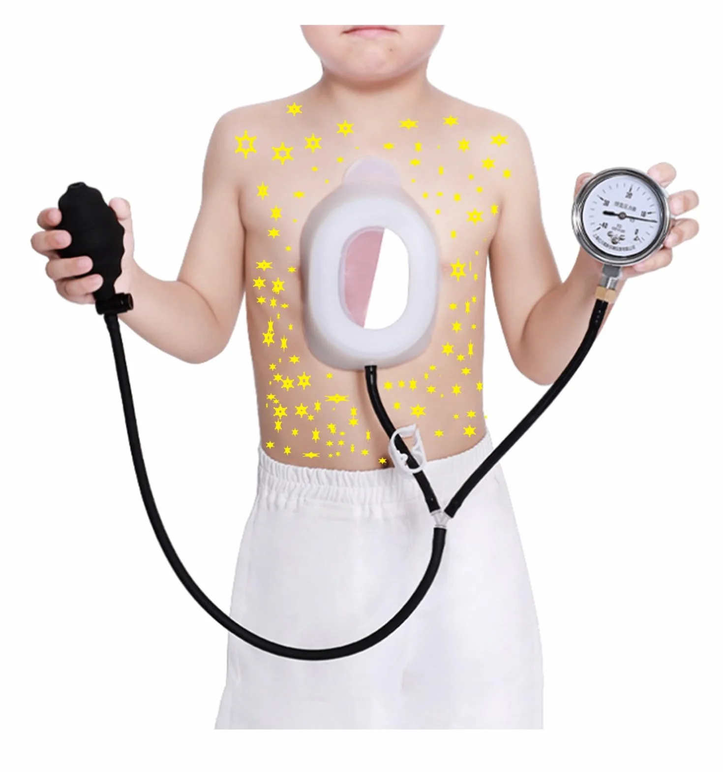 Pectus Excavatum Orteza Pectus Excavatum Fizyczna korekcja Pectus Excavatum dla dorosłych i dzieci, zasada korekcji Pectus Excavatum (M)