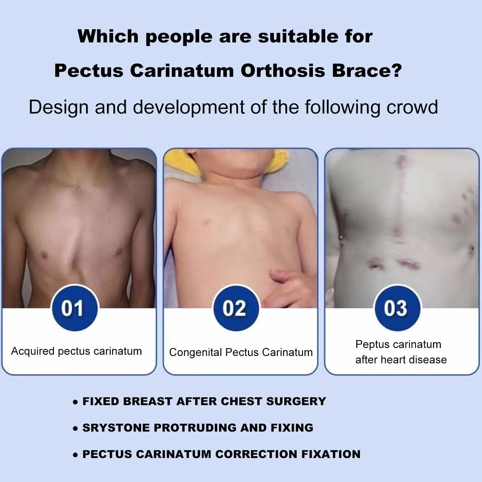 NICHOY Ortezy Pectus Carinatum dla dorosłych: uchwyt na klatkę piersiową gołębicy z regulatorem rozmiaru, szelki z żebrami koślawymi, łatwe w użyciu (regulowany model)