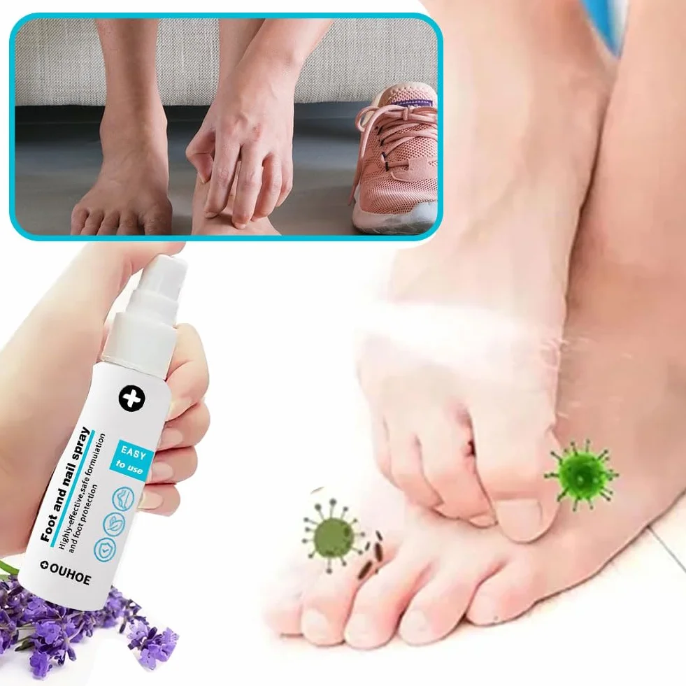Spray do stóp i paznokci, 2 sztuki, do pielęgnacji stóp, usuwanie nieprzyjemnych zapachów, dla mężczyzn i kobiet, 30 ml
