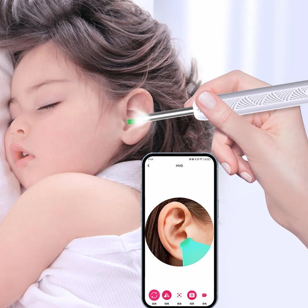 1 PC Aparat Bezprzewodowy Otoskop USB C Ładowanie Narzędzie do usuwania wosku z uszu Mini Kamera