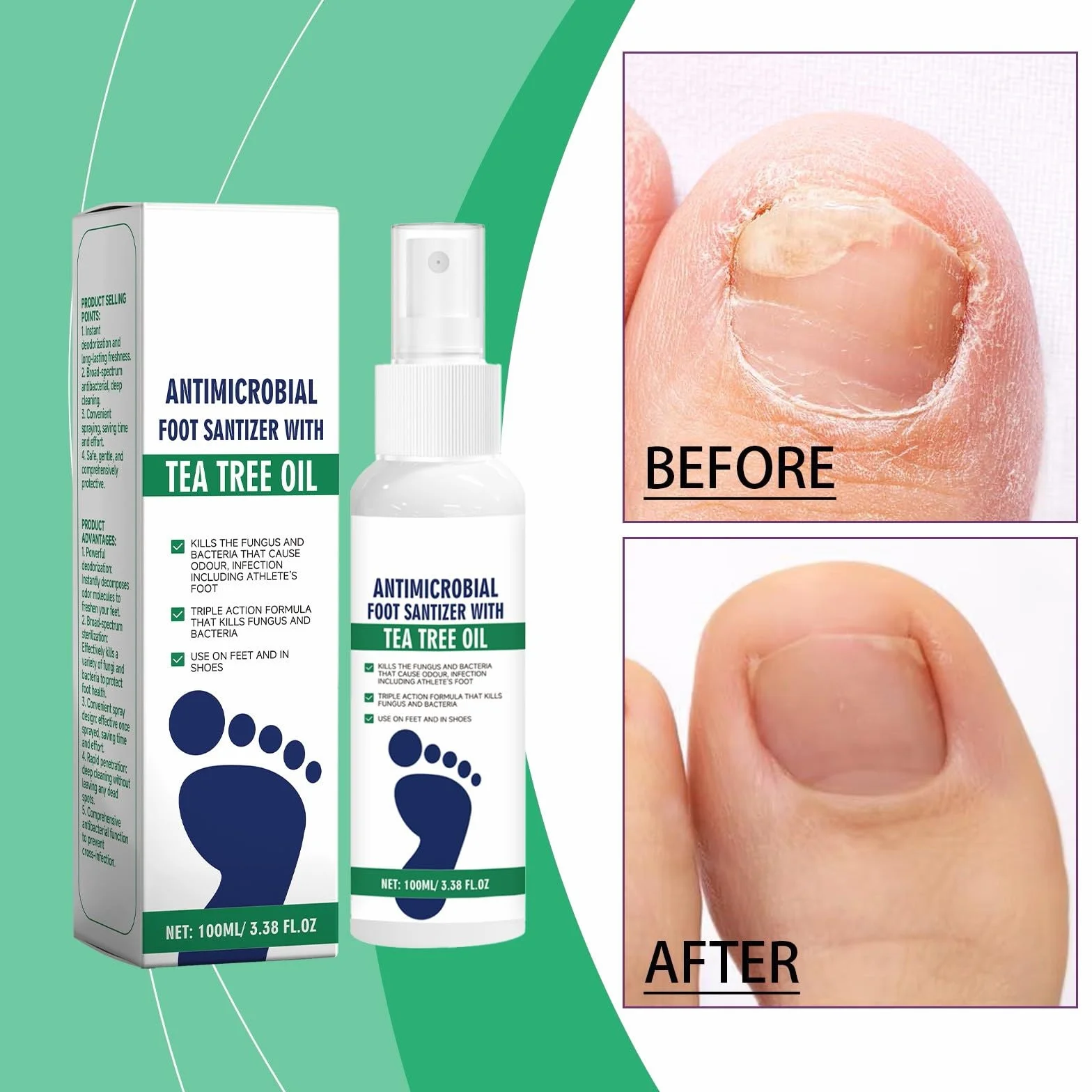 2 szt. Olejek do pielęgnacji stóp do herbaty, naturalny olejek z drzewa herbacianego i aloesowy spray do stóp, serum do pielęgnacji stóp i paznokci, szybkie suszenie i przyjazne dla podróży