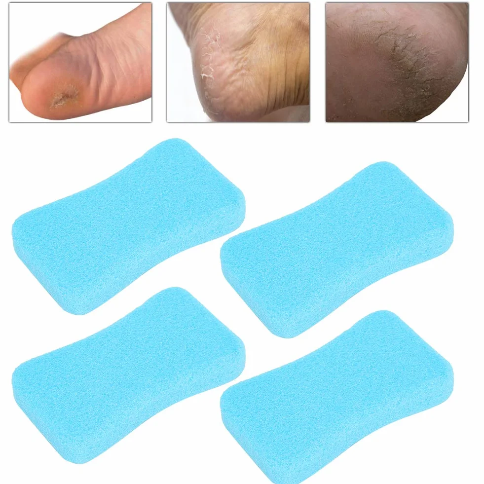 Pumeks do stóp 4 sztuki Peeling kamienia usuwanie kalusa twardej skóry Pedicure Scrubber niebieski