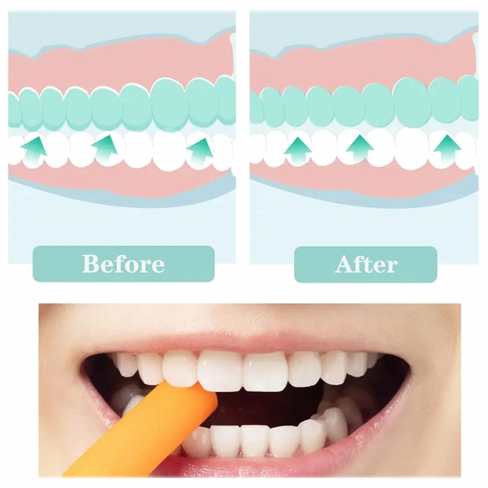Aligner Chompers gryzaki ortodontyczne 6 kolorów wielokrotnego użytku