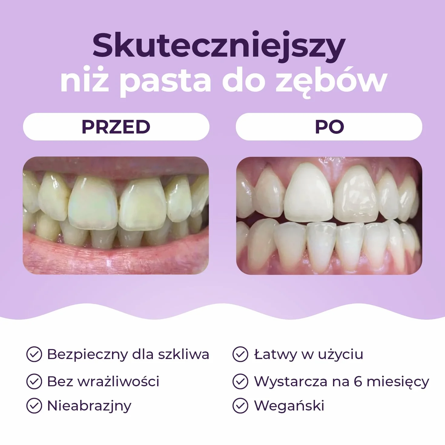 Onlysmile wybielanie zębów w proszku do białych | Wybielanie zębów z widocznym efektem oczyszczającym | Wybielanie zębów - Kosmetyczne czyszczenie zębów