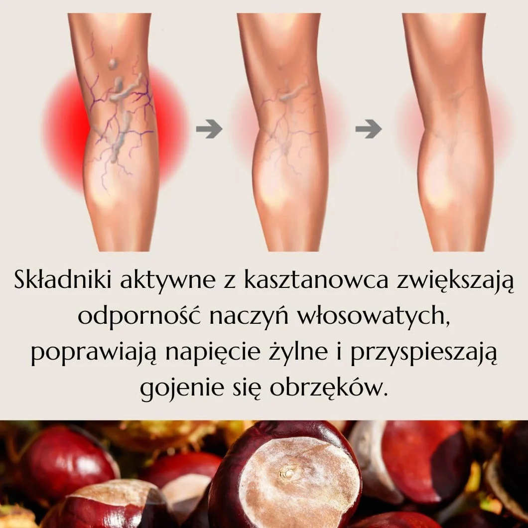 Green idea – Maść kasztanowa na żylaki - kasztanowiec, arnika, rutyna - na pajączki i hemoroidy - maść żylna 200 ml