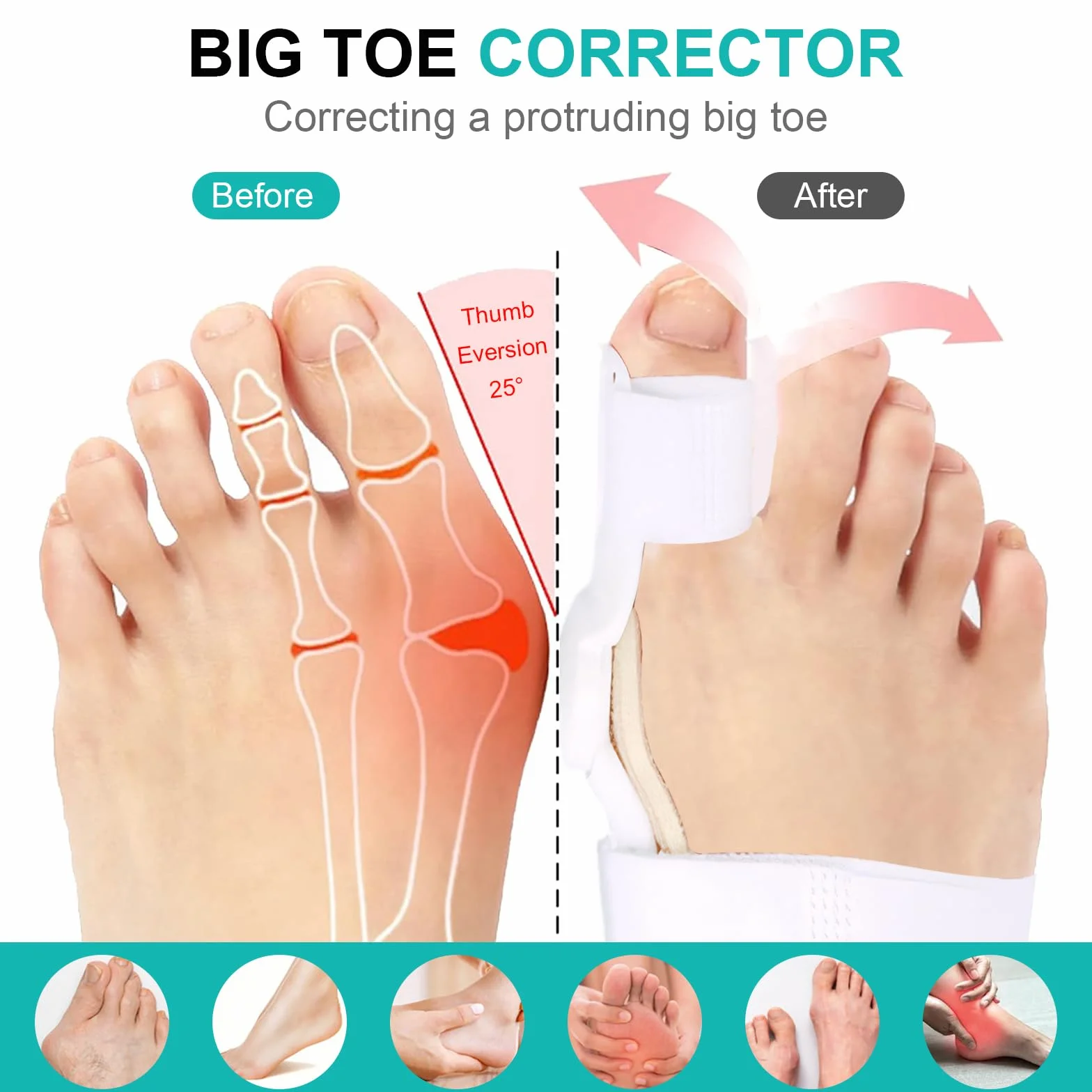 Naapesi 2 sztuki korekta hallux valgus, szyna hallux valgus dla kobiet i mężczyzn, regulowany rozszerzacz palców hallux valgus do łagodzenia bólu, do noszenia w dzień i w nocy (uniwersalny rozmiar)
