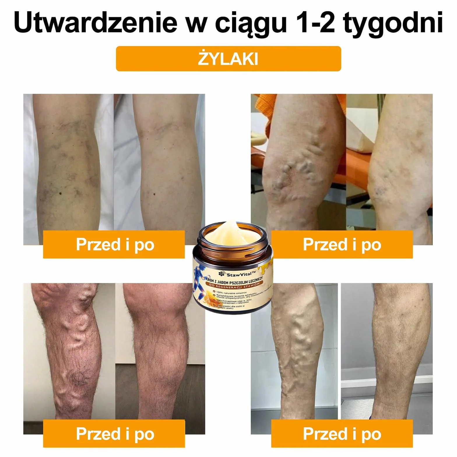 StawVital Kremz Jadem Pszczelim Leczniczy do Regeneracjistawów,Krem jadu pszczelego do stawów i kości, Bee Venom Crem, maść na jad pszczeli, 30 ml (1)