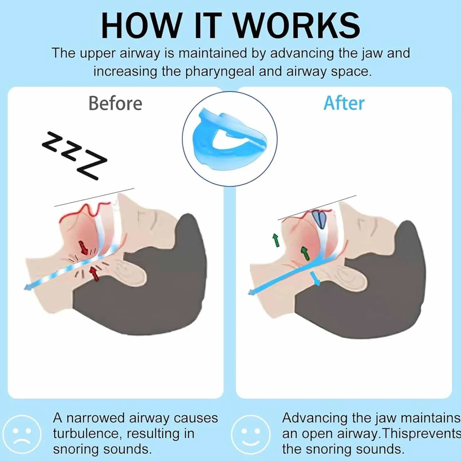 Anti Snoring Mouthpiece - Universal Size,Anti Snoring Devices for Sleep,Food Grade Material Snore Mouth Guard,Instantly Quiet Antisnoring Device Mouthpiece,Make The Night Quiet (2)