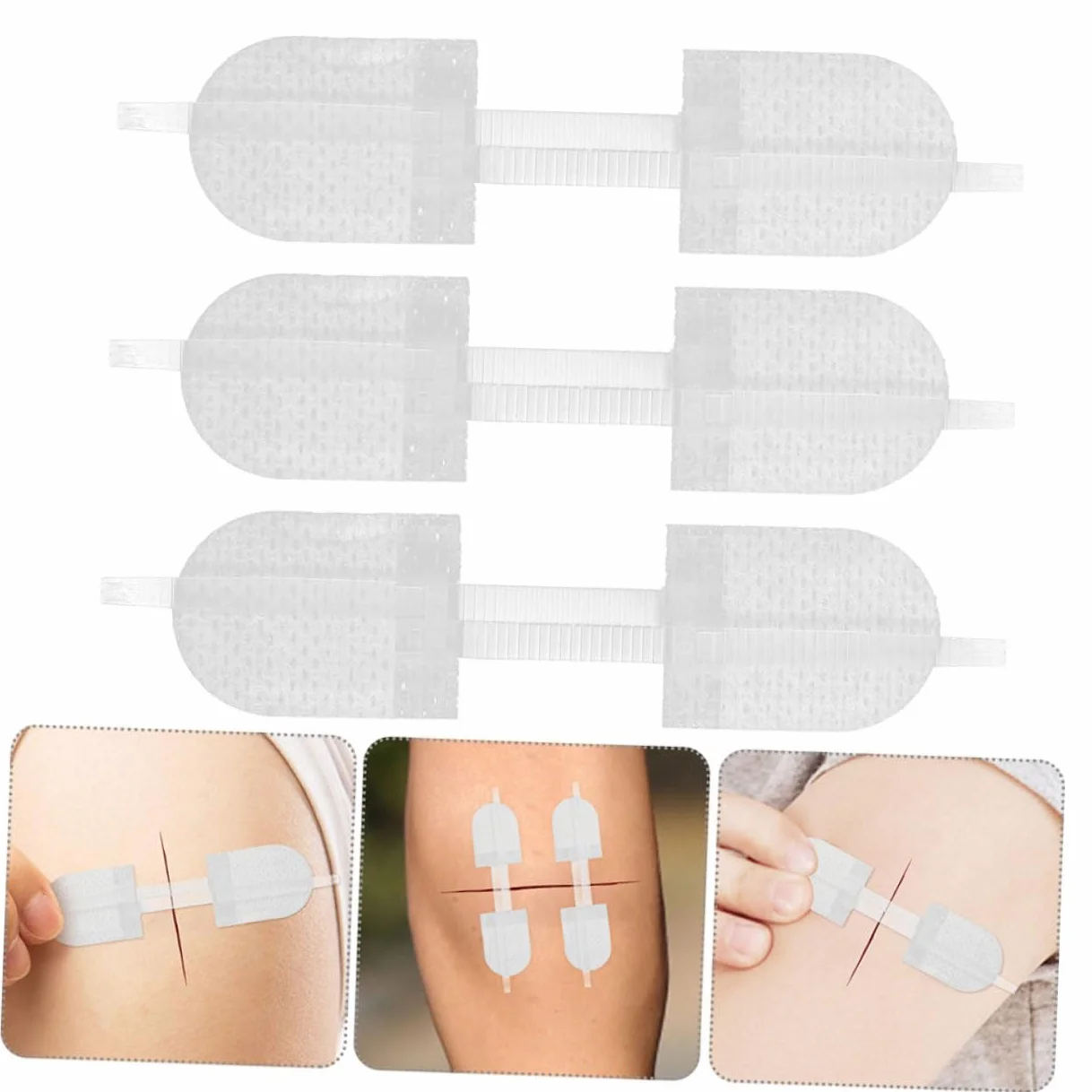 Yardenfun 6 Sztuk Zip Wound Close Bandages Butterfly Closure Strips Quick Stitch Wound Care for Finger And Knuckle Portable Outdoor Emergency Use