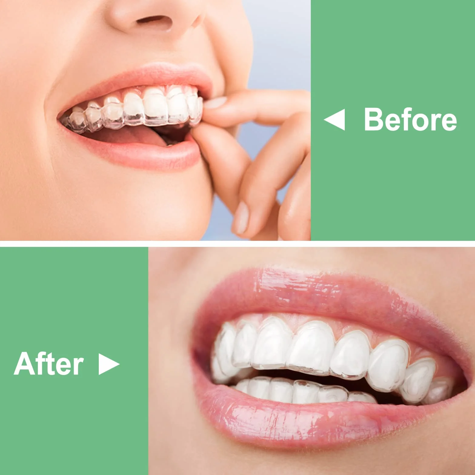 BVN Aligner Chewies 20 sztuk do Aligner Chompers zielona