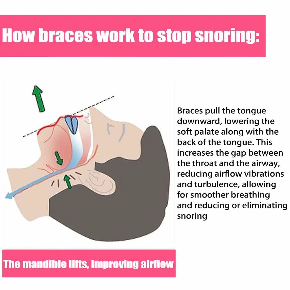 Anti-Snoring Mouthpiece,Food Grade Silicone Material Snore Mouth Guard,Instantly Quiet Antisnoring Device Mouthpiece,Make The Night Quiet,Universal Size for Women & Men (2pcs)