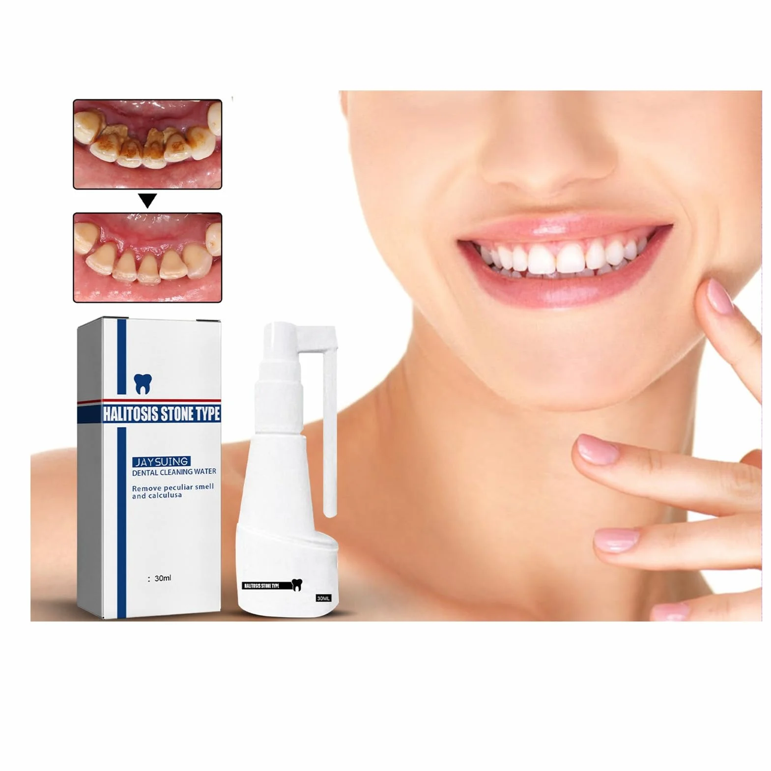 Spray do czyszczenia kamieni zębowych, 30 ml Spray do czyszczenia jamy ustnej Usuń kamień nazębny oddech odświeżający spray do czyszczenia zębów