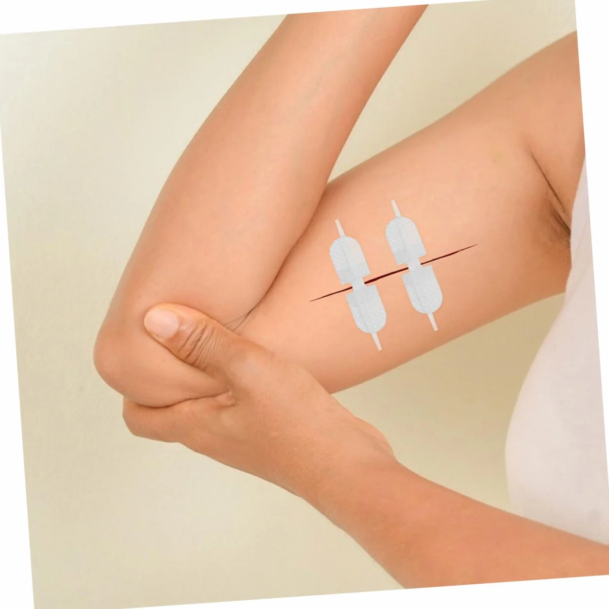 6 Sztuk Quick Stitch Zip Closure Bandages Butterfly Wound Care Strips Breathable Fabric for Finger Knuckle Injuries Portable Secure Adhesion Wound Closure