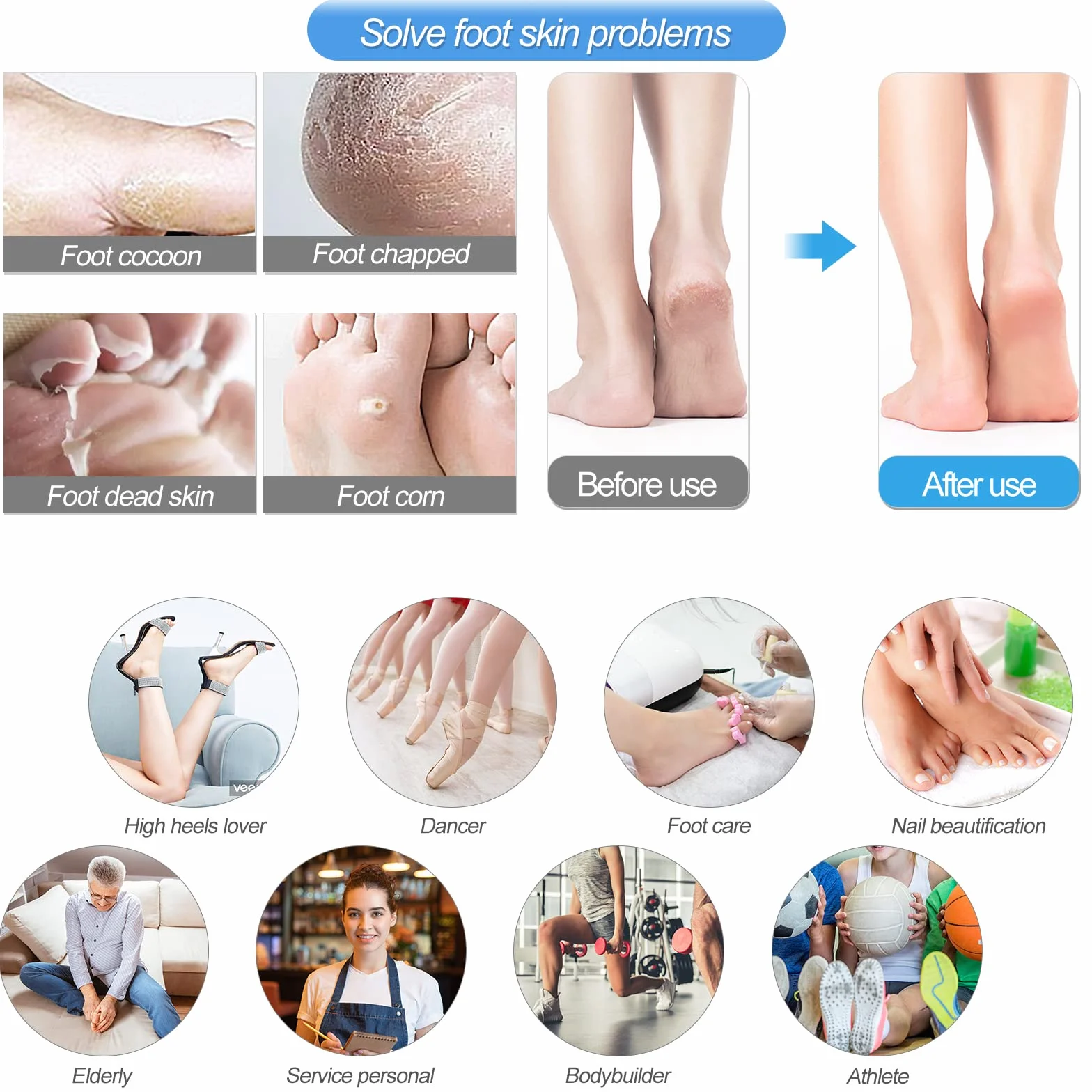 Sularpek Zestaw pilników do pedicure, profesjonalny zestaw do pedicure, pedicure, profesjonalny zestaw do pedicure, do grubych paznokci, pęknięty pilnik do stóp, zestaw do usuwania zrogowaciałów, narzędzie do pielęgnacji paznokci