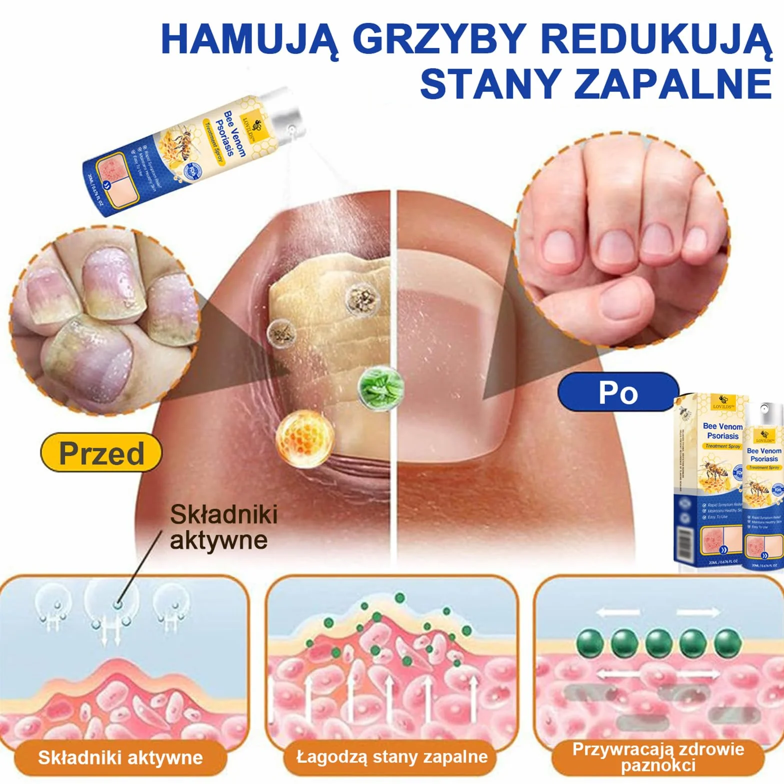 LOVILDS PsoriaHeal Sprayna, Profesjonalny Bee Venom Spray, LOVILDS Bee Venom Psoriasis Spray, Naturalne składniki, dla każdego (4)