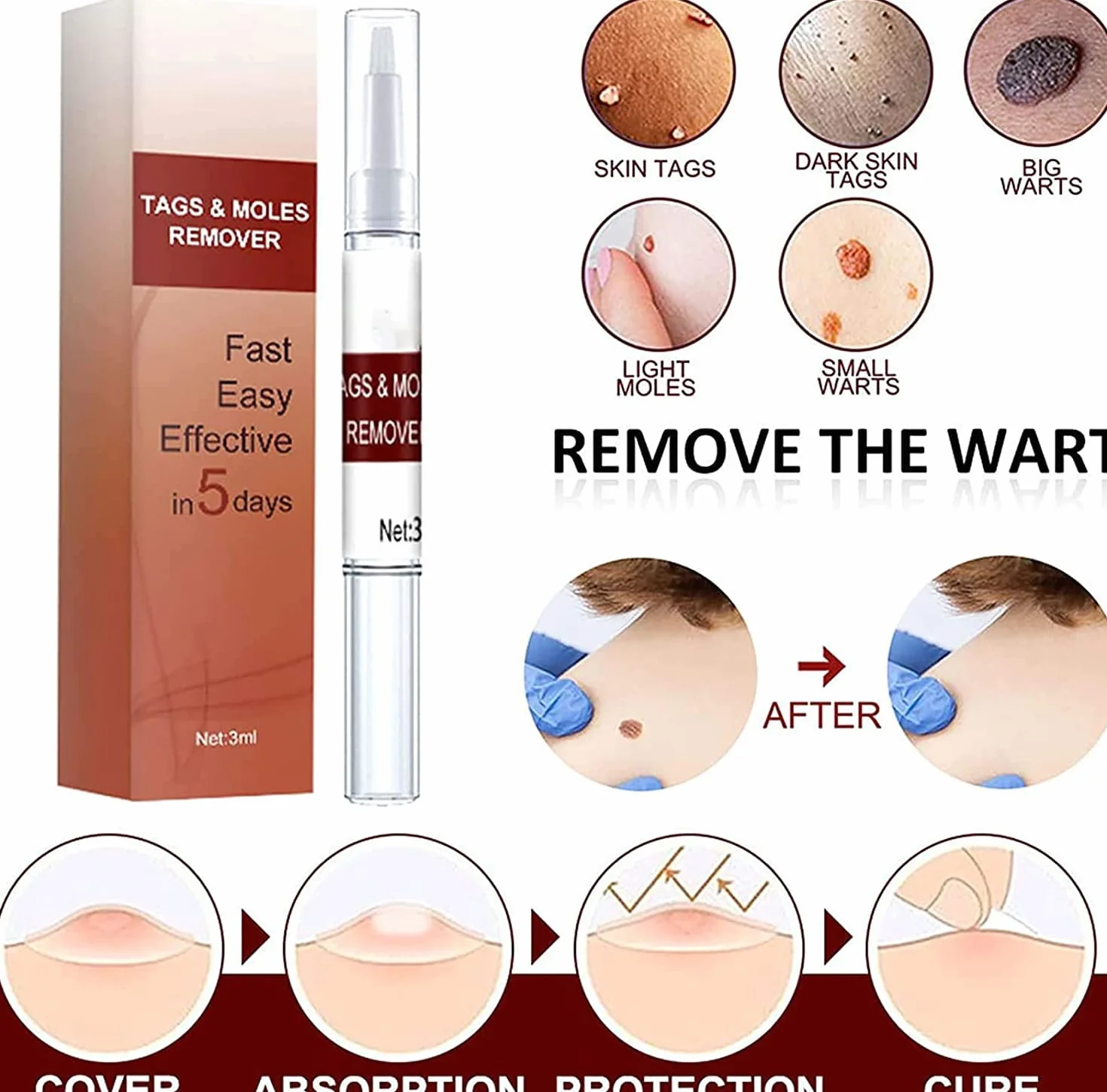 Skin Tag Remover & Mole Remover Wipeoff Tags, 3 Pcs, Quick Safe Remove
