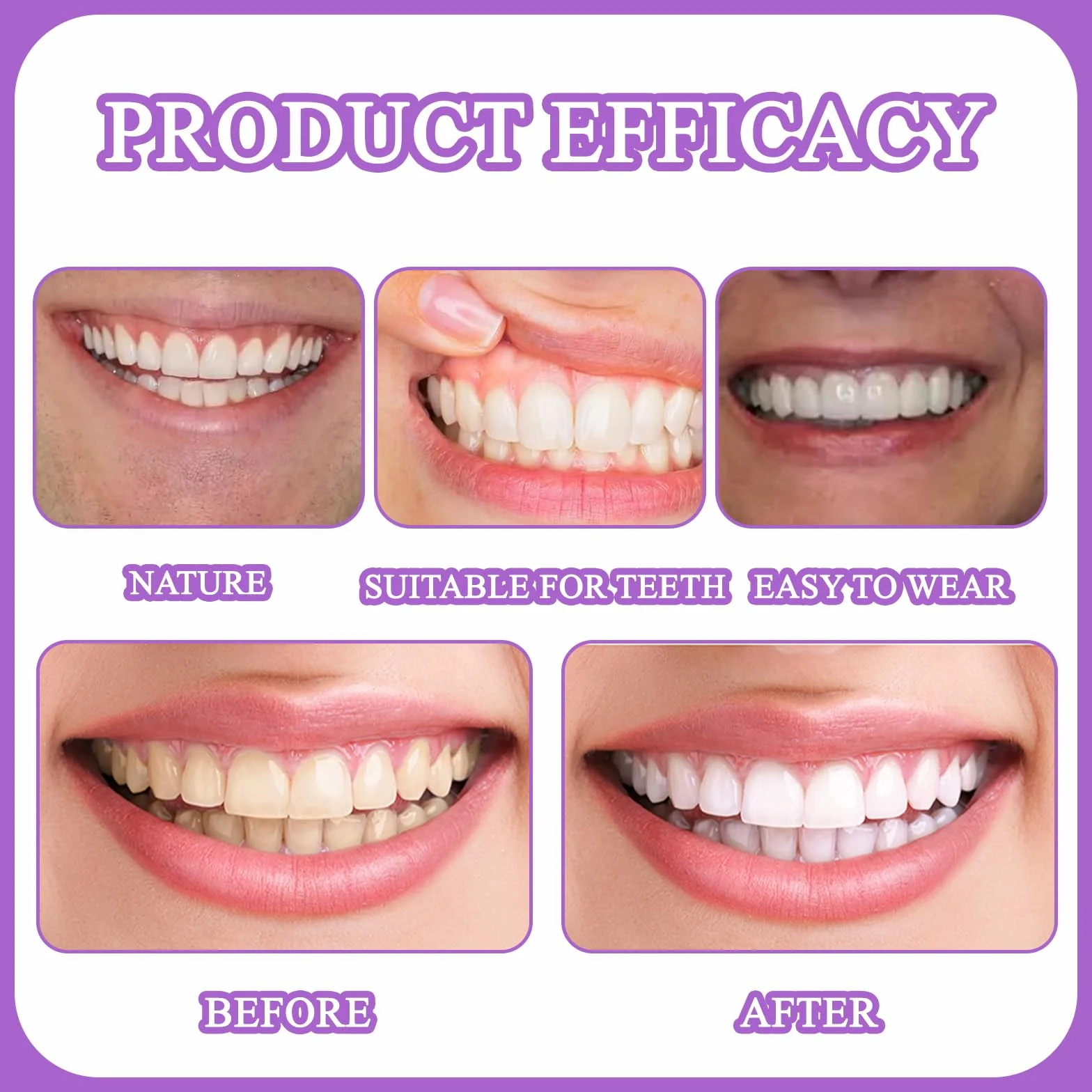 Protezy Silikonowe Bikenda Silicone Reline Denture Set Łagodzą dyskomfort Łatwe w użyciu Precyzyjne dopasowanie Naturalny komfort Odpowiednie dla kobiet i mężczyzn