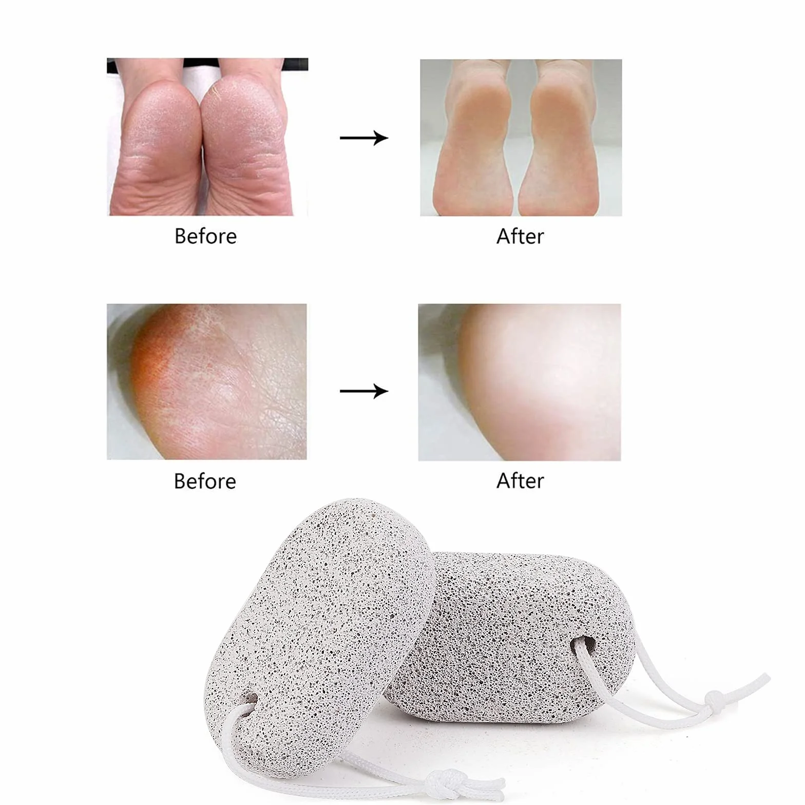 Naturalny pumeks do stóp 3 szt., narzędzia do pedicure PHOGARY Lava narzędzia do pedicure z twardą skórą, środek do usuwania zrogowaciałego naskórka