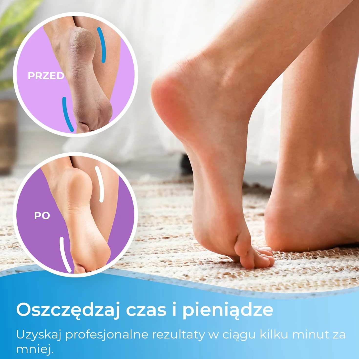 My Rollers Końcówki Rolki Głowice Obrotowe do Frezarki do Pięt Pilnika Elektrycznego, Wkłady Silnie Ścierające, Kompatybilne z Scholl Express Pedi, 4 szt