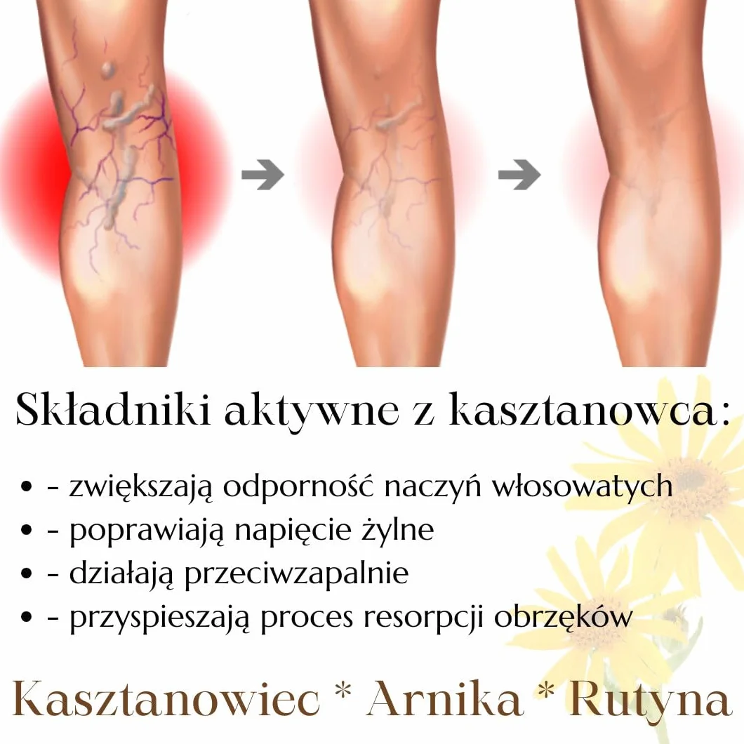 Green idea - Krem do Żylaków 250 ml – Maść z Kasztanowca – Krem na Nogi z Arniką, Kasztanowcem, Rutyną – Przeciwko Żylnym Pajączkom i Hemoroidom – Wyprodukowano w UE