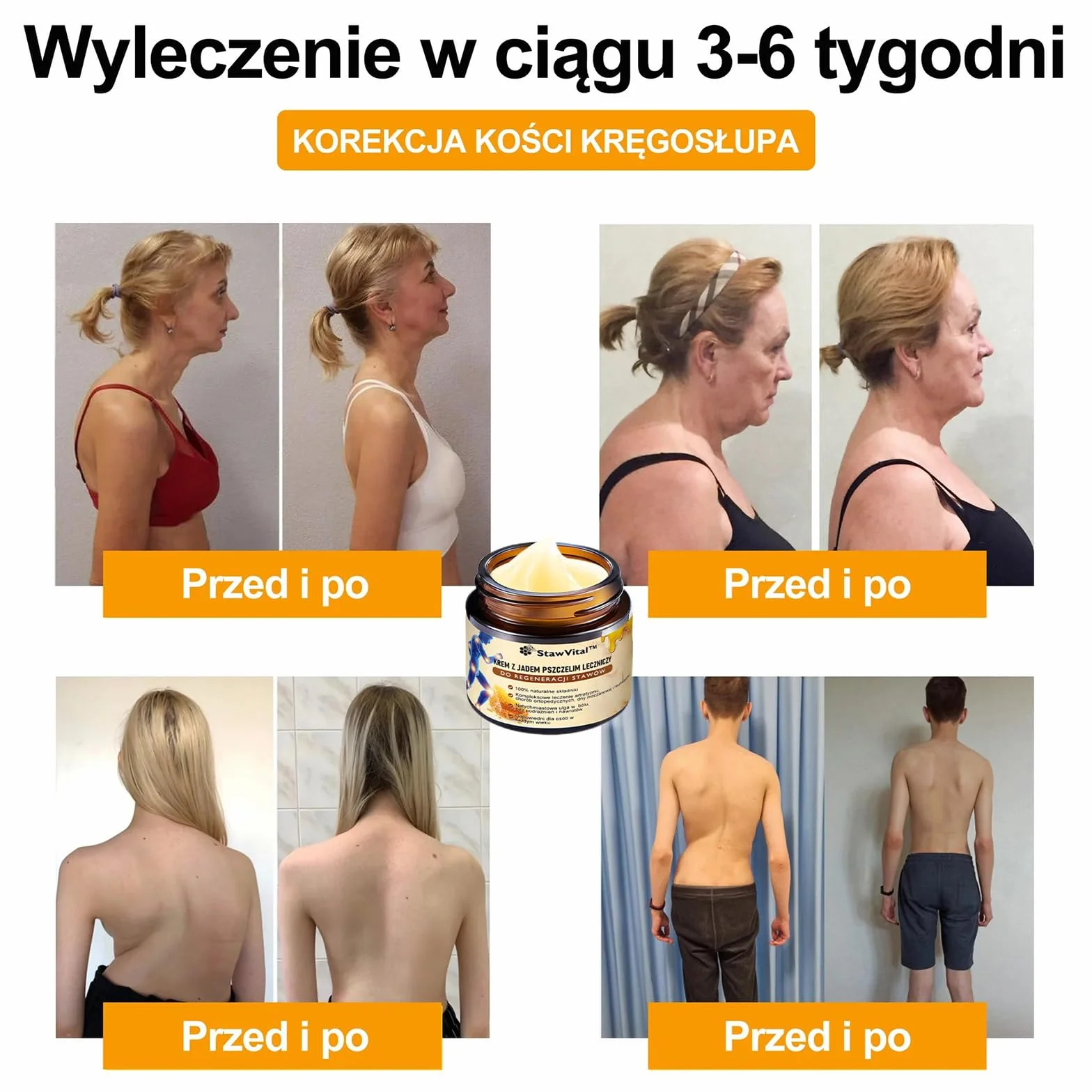 StawVital Kremz Jadem Pszczelim Leczniczy do Regeneracjistawów,Krem jadu pszczelego do stawów i kości, Bee Venom Crem, maść na jad pszczeli, 30 ml (1)