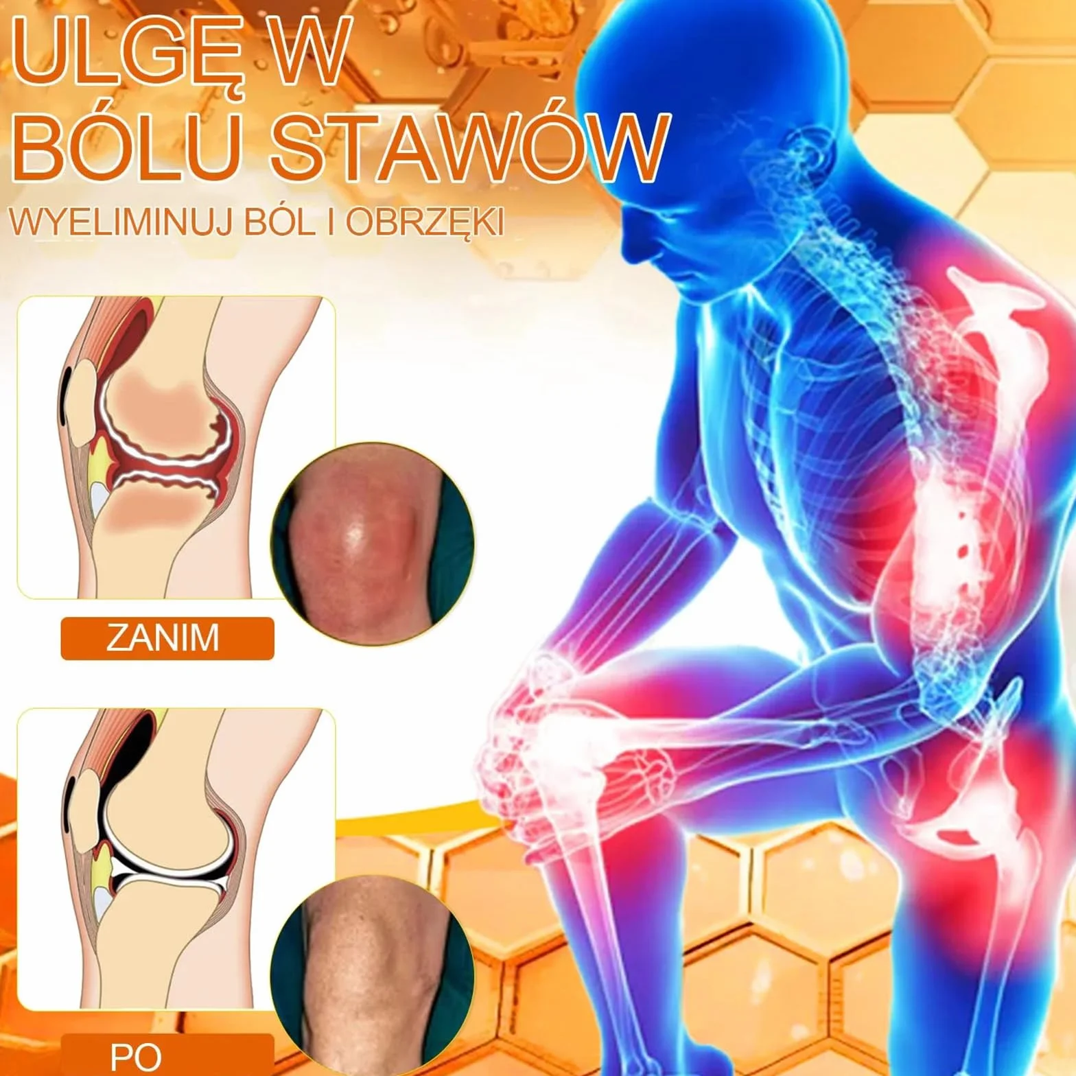 StawVital Kremz Jadem Pszczelim Leczniczy do Regeneracjistawów,Krem jadu pszczelego do stawów i kości, Bee Venom Crem, maść na jad pszczeli, 30 ml (1)