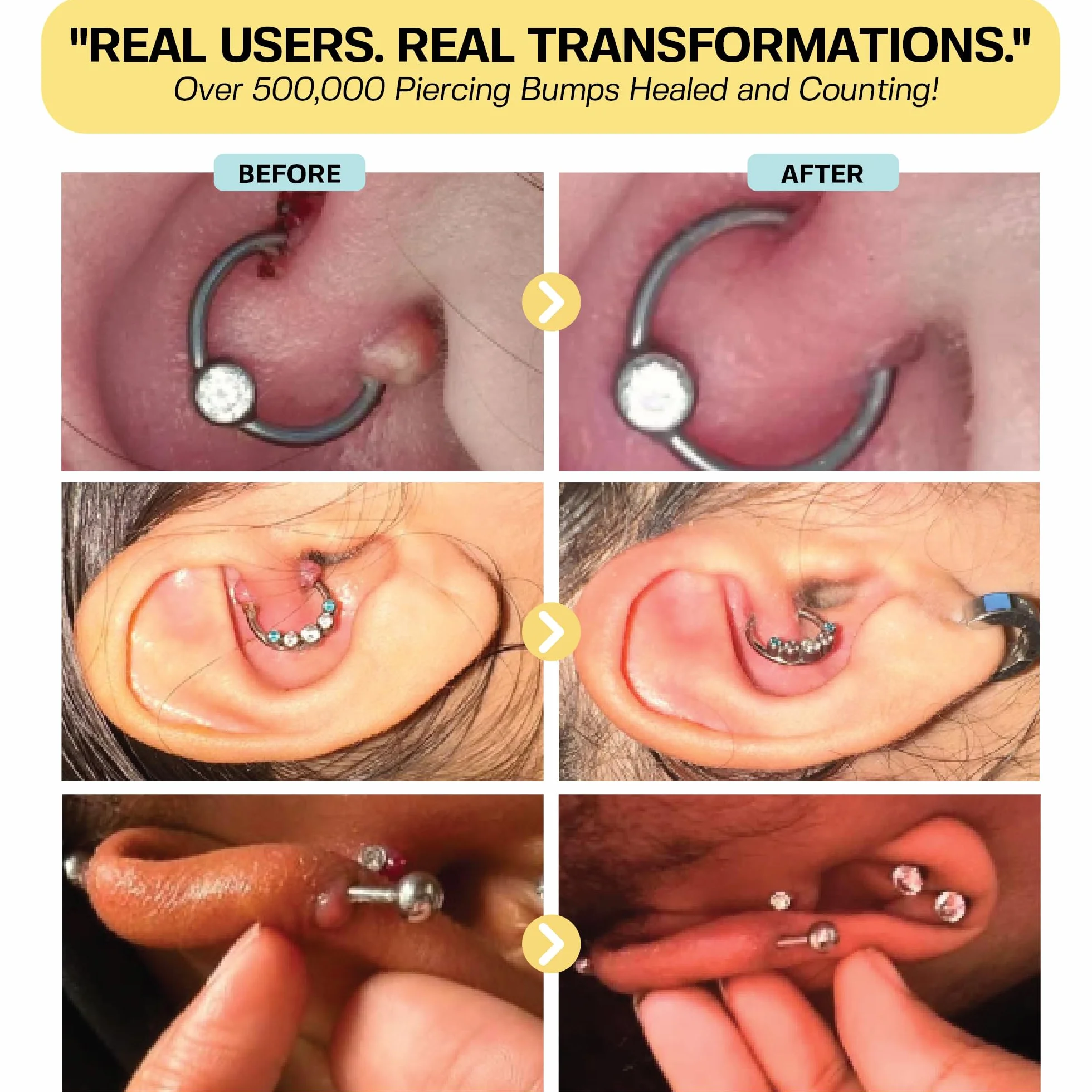 base labs keloid scar gel